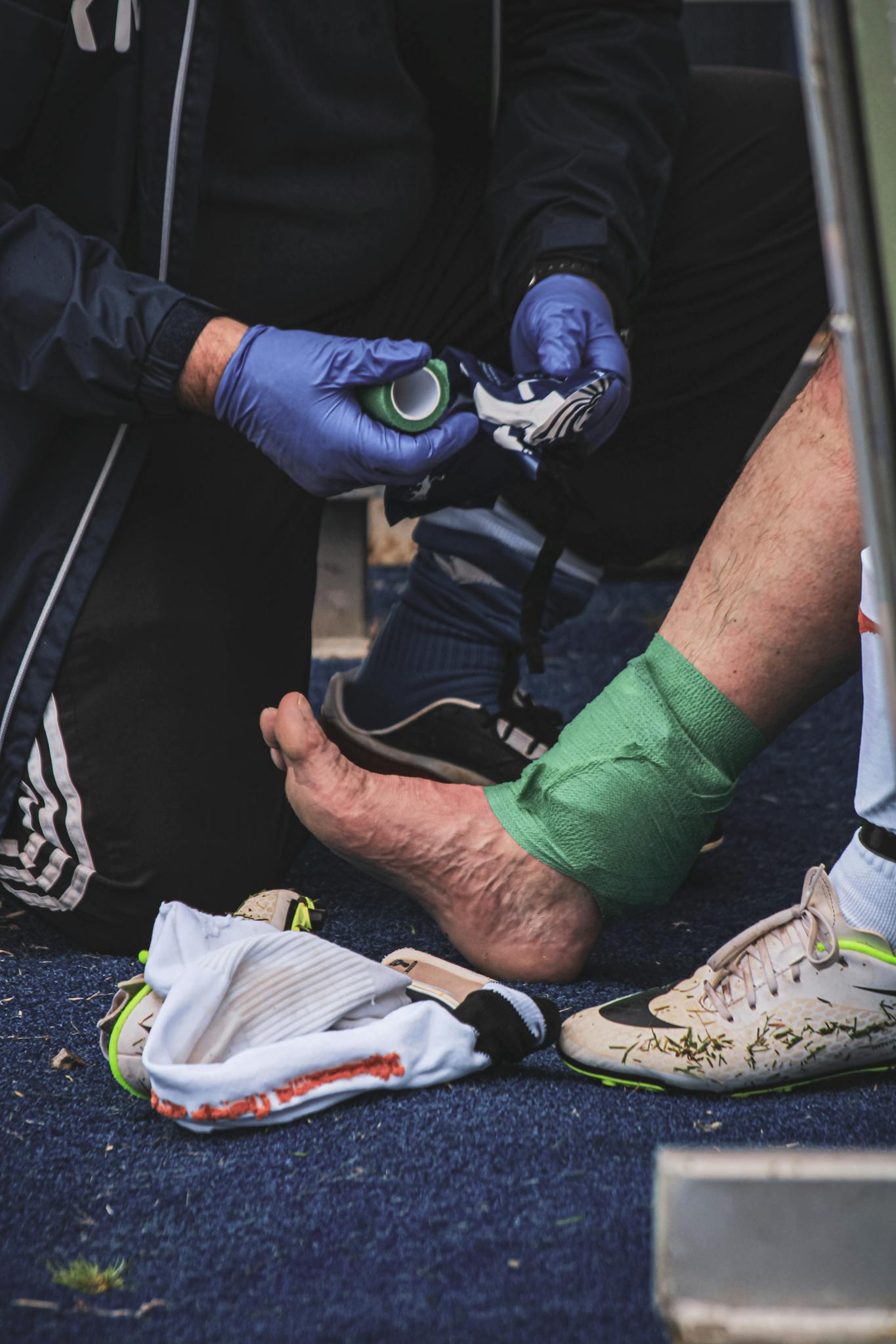 Close-up of a soccer player's foot being treated for an injury on the sidelines.